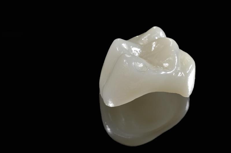 Porcelain Crowns Phoenix, AZ